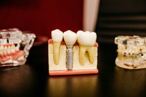 Cyber Security Services For Dental Practices 3 Why Dental Practices Are Prime Targets For Cyber Attacks